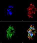 LRRK2 Antibody in Immunocytochemistry (ICC/IF)