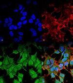 Kir6.1 (KCNJ8) Antibody in Immunocytochemistry (ICC/IF)