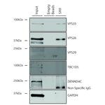 VPS35 Antibody in Immunoprecipitation (IP)