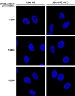 VPS35 Antibody in Immunocytochemistry (ICC/IF)