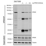 VPS35 Antibody in Immunoprecipitation (IP)