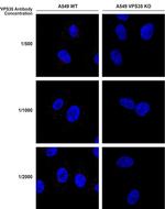 VPS35 Antibody in Immunocytochemistry (ICC/IF)