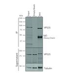 VPS35 Antibody in Immunoprecipitation (IP)