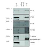 VPS35 Antibody in Immunoprecipitation (IP)