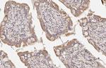 CPT1A Antibody in Immunohistochemistry (Paraffin) (IHC (P))