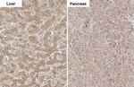 CPT1A Antibody in Immunohistochemistry (Paraffin) (IHC (P))