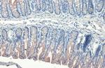 Cytokeratin 19 Antibody in Immunohistochemistry (Paraffin) (IHC (P))