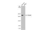 COL4A1 Antibody in Western Blot (WB)