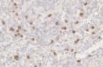 p53R2 Antibody in Immunohistochemistry (Paraffin) (IHC (P))