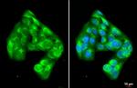 PI3K p85 alpha Antibody in Immunocytochemistry (ICC/IF)