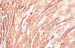 Cardiac Troponin I Antibody in Immunohistochemistry (Paraffin) (IHC (P))