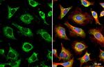 GRK2 Antibody in Immunocytochemistry (ICC/IF)