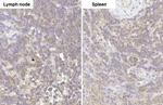 GRK2 Antibody in Immunohistochemistry (Paraffin) (IHC (P))