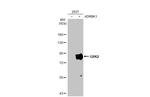 GRK2 Antibody in Western Blot (WB)