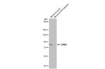 GRK2 Antibody in Western Blot (WB)