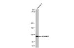 ADAM17 Antibody in Western Blot (WB)