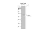 VGAT Antibody in Western Blot (WB)