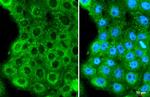 HPV Type 16 E7 Antibody in Immunocytochemistry (ICC/IF)