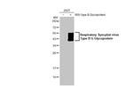 RSV Type B Glycoprotein G Antibody in Western Blot (WB)