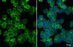 TREM2 Antibody in Immunocytochemistry (ICC/IF)