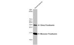 Transthyretin Antibody in Western Blot (WB)