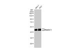 Ataxin 3 Antibody in Western Blot (WB)