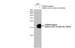 SARS-CoV-2 ORF9b Antibody in Western Blot (WB)