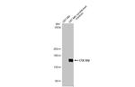 COL1A2 Antibody in Western Blot (WB)