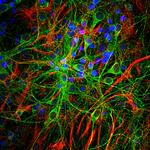 Tau Antibody in Immunocytochemistry (ICC/IF)