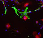 Aldolase A/B/C Antibody in Immunocytochemistry (ICC/IF)