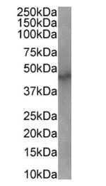 RAD23B Antibody in Western Blot (WB)