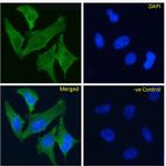 TrkA Chimeric Antibody in Immunocytochemistry (ICC/IF)