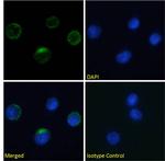 Integrin beta 7 Chimeric Antibody in Immunocytochemistry (ICC/IF)