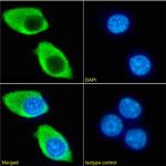 CD122 Chimeric Antibody in Immunocytochemistry (ICC/IF)