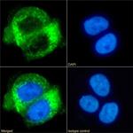 CD63 Chimeric Antibody in Immunocytochemistry (ICC/IF)