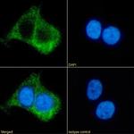 beta-2 Adrenergic Receptor Chimeric Antibody in Immunocytochemistry (ICC/IF)