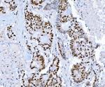 SP1 Antibody in Immunohistochemistry (Paraffin) (IHC (P))