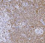 SP1 Antibody in Immunohistochemistry (Paraffin) (IHC (P))