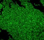 MCM2 Antibody in Immunohistochemistry (Paraffin) (IHC (P))