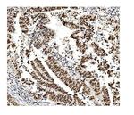 MCM2 Antibody in Immunohistochemistry (Paraffin) (IHC (P))