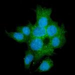 TGFBR2 Antibody in Immunocytochemistry (ICC/IF)