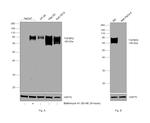 TGFBR2 Antibody in Western Blot (WB)