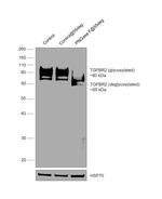 TGFBR2 Antibody in Western Blot (WB)