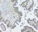 GNAQ Antibody in Immunohistochemistry (Paraffin) (IHC (P))