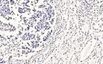 SF1 Antibody in Immunohistochemistry (Paraffin) (IHC (P))