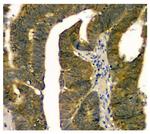 STUB1 Antibody in Immunohistochemistry (Paraffin) (IHC (P))