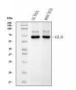 Glutaminase Antibody in Western Blot (WB)