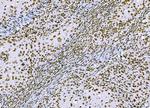 CtBP2 Antibody in Immunohistochemistry (Paraffin) (IHC (P))