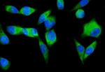 SND1 Antibody in Immunocytochemistry (ICC/IF)