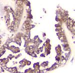 Cyclophilin B Antibody in Immunohistochemistry (Paraffin) (IHC (P))